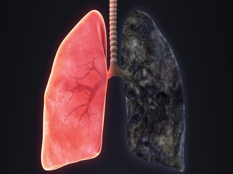 E Sigaranın Vücudumuza Verdiği Büyük Zararlar3