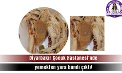 Diyarbakır Çocuk Hastanesi’nde yemekten yara bandı çıktı!