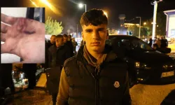 Mardin kayyım protestolarında 17 yaşındaki genç polis tarafından darp edildi