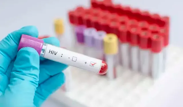 HIV ve AIDS hakkında toplumsal farkındalık çağrısı