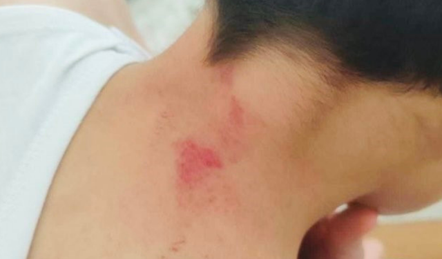 Şanlıurfa’da öğrencisini darp eden öğretmen tutuklandı