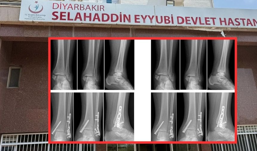 Diyarbakır’da sağlam kemiğe platin takan, 2 doktora ihraç talebi